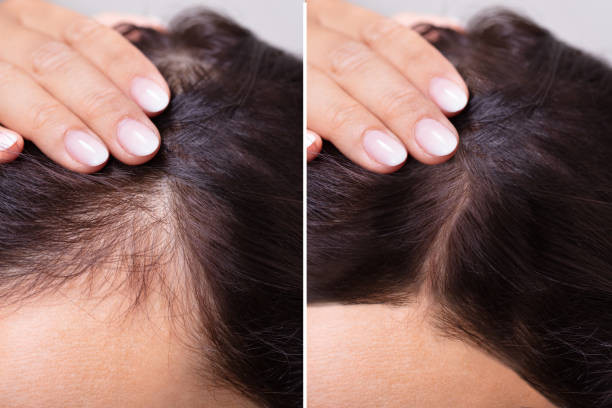 Các dấu hiệu tóc mọc lại