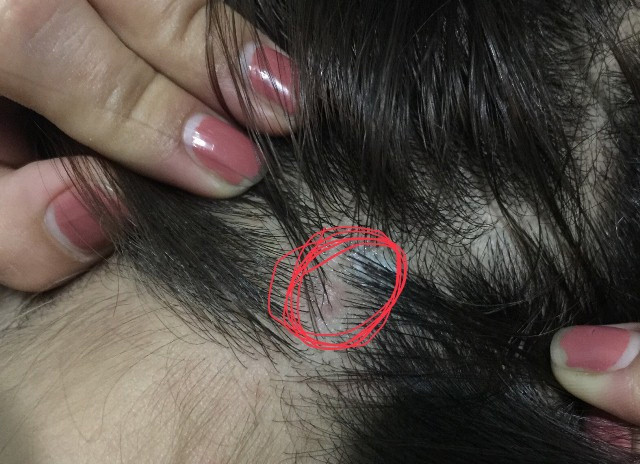 Tác động phụ của thuốc nhuộm tóc